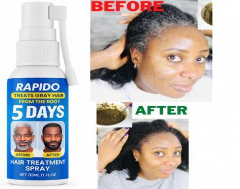 Rapido 5 DAYS Gray Hair Treatment Spray Gray Beards To Black Beard Growth – Restores Natural Black Hair From The Root-30ml